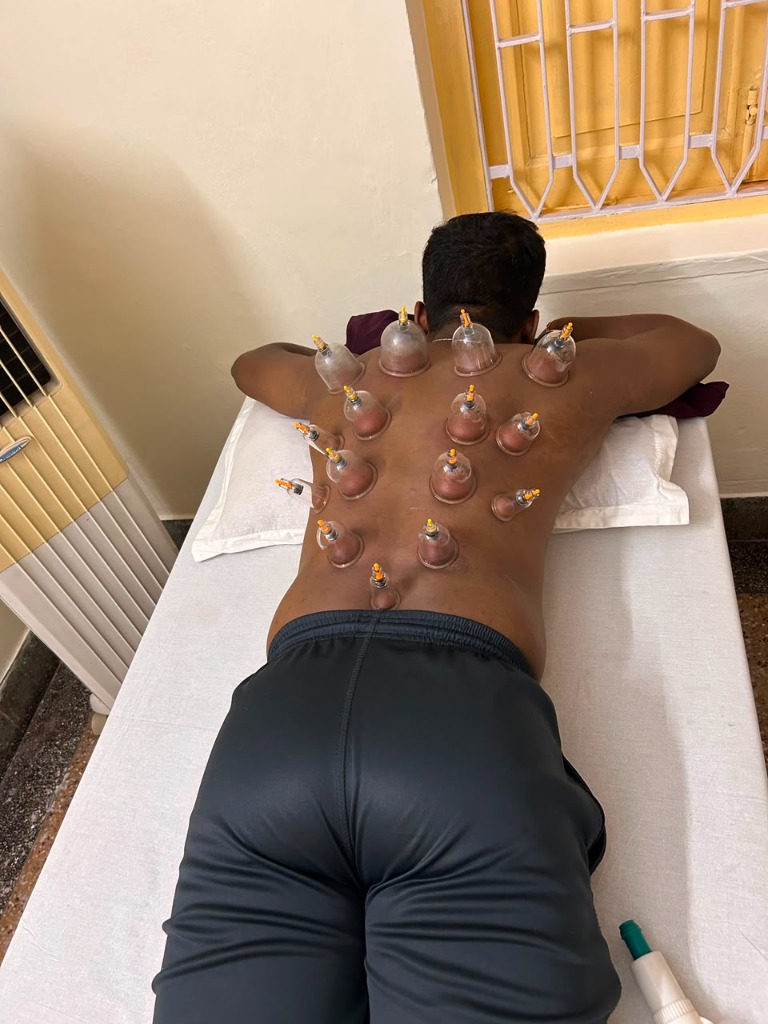 Best Cup Therapy in Patna: Cup therapy in Rajeev Nagar Patna