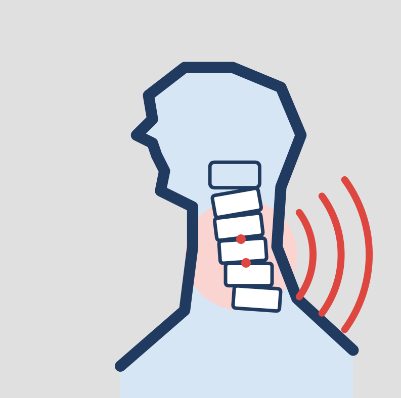 Neck Pain & Stiffness